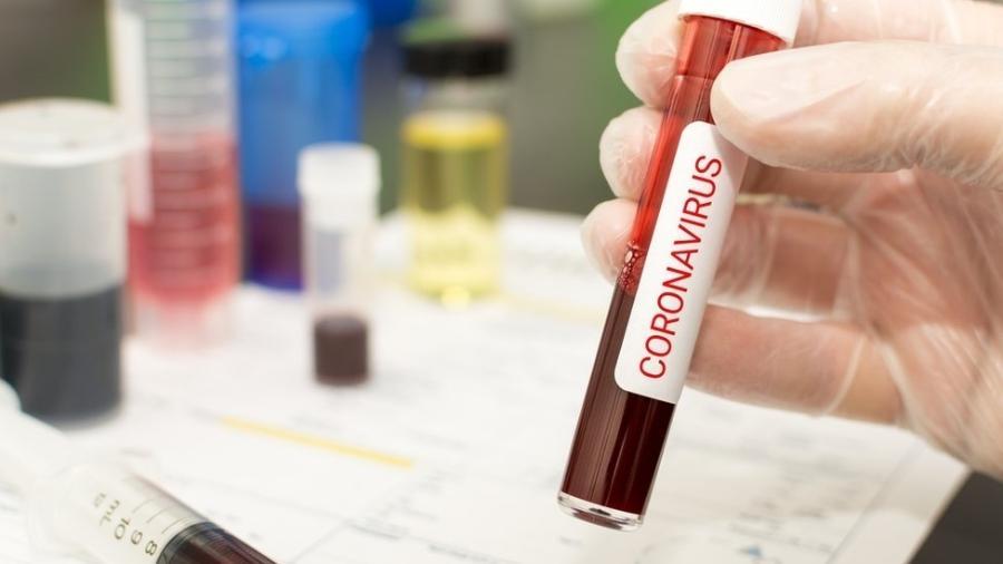 Menina de 12 anos morre vítima do coronavírus na Bélgica