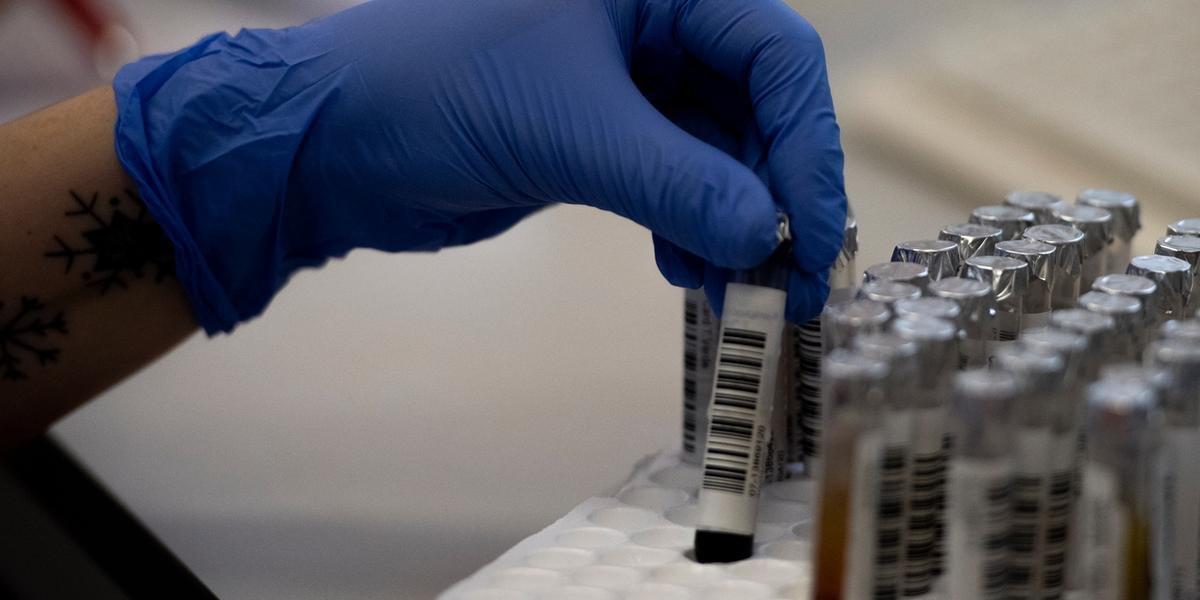 Mundo já tem mais de 375 mil mortos por Covid-19