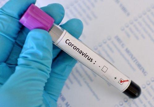 Número de mortes por coronavírus no mundo supera 475.000