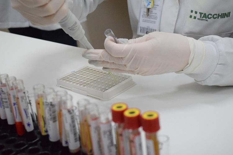 Tacchini identifica novas variantes da Covid-19 na Serra Gaúcha