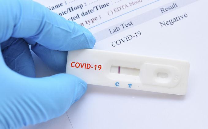 Rio Grande do Sul registra 3.920 novos casos de Covid-19 e mais 109 mortes provocadas pela doença