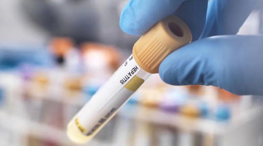 Ministério da Saúde investiga 28 casos suspeitos de hepatite aguda grave no País